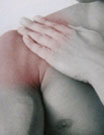 Fibromyalgia