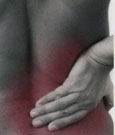 Sciatica